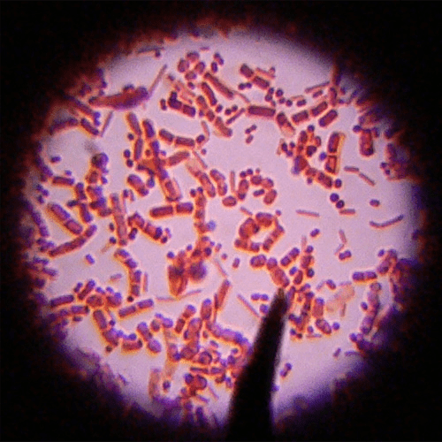 Bacteria Under a Microscope Image Source: Flickr via Umberto Salvagnin 