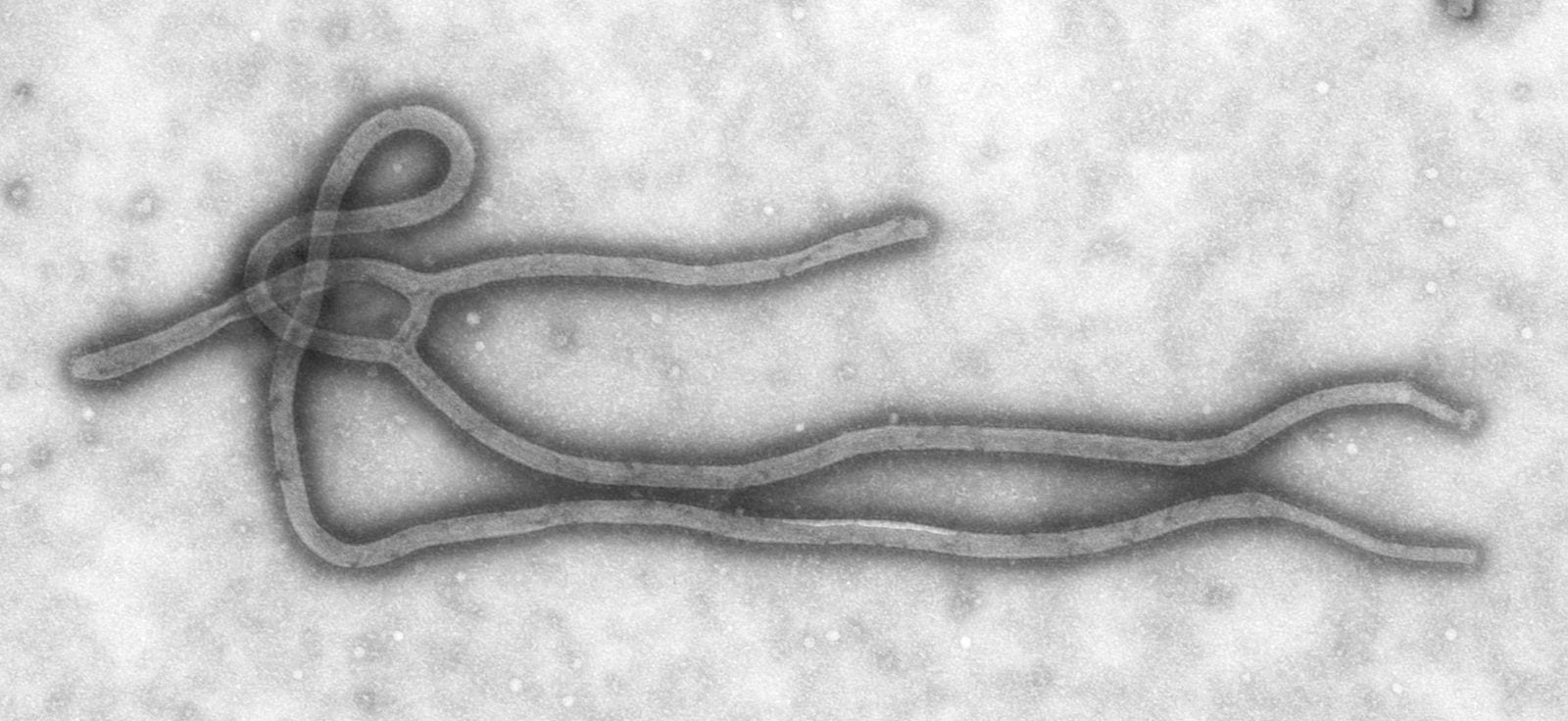 Ebola_Virus_TEM_PHIL_1832_lores